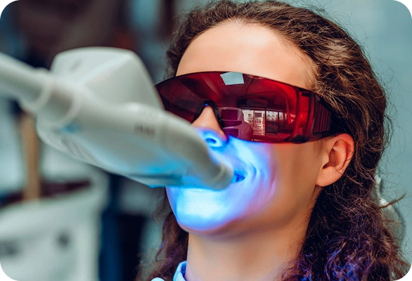 tratamiento de blanqueamiento